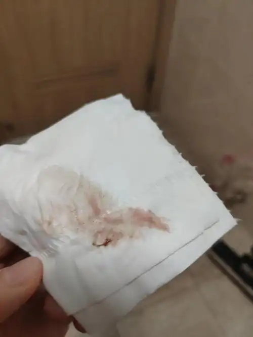 白带带血什么情况?