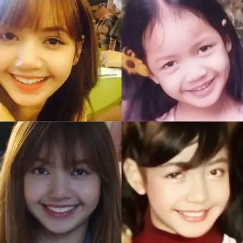 澄清lisa到底有没有整容