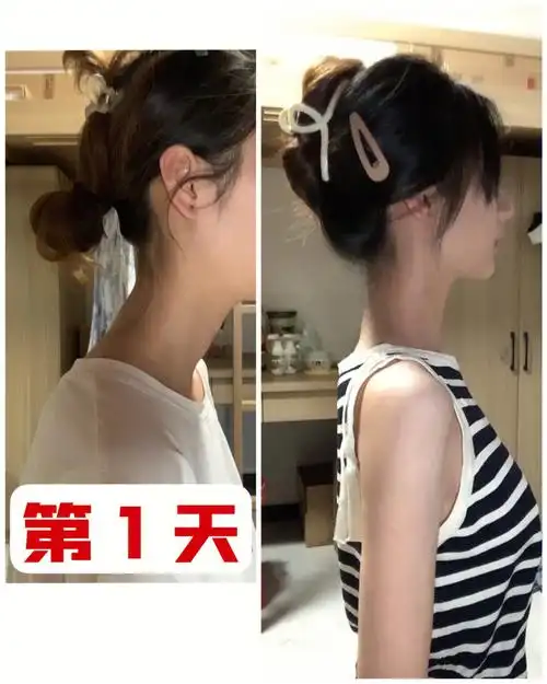 每天五分钟有效改善脖子前倾