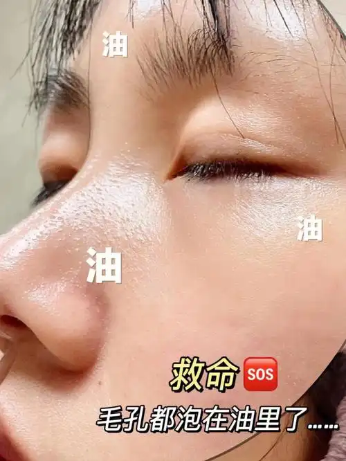 25岁大湖北普通油皮姐弟肤质改善战