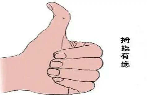 女人小指上有痣代表什么 小指有痣解析_达一风水网