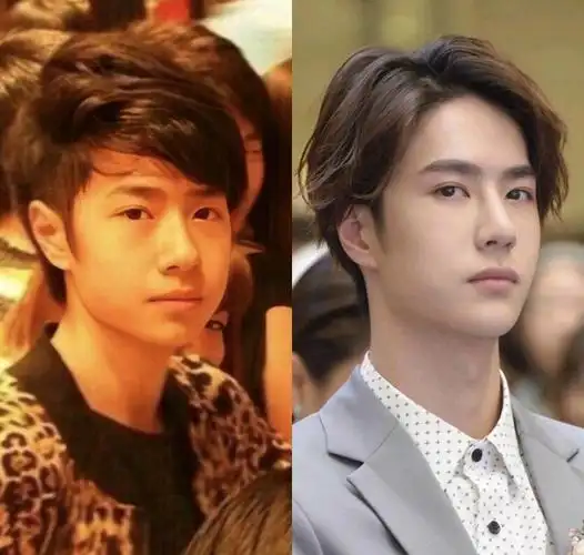 王一博整容传闻缠身,高清照片暴露证据,网友:确认了