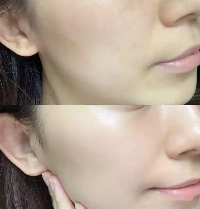 日本这个70块的美白精华简直逆天改善暗沉肤色不均难怪被称为平价skii