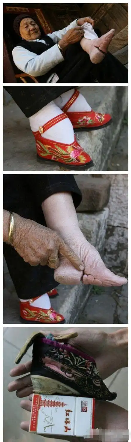 人们把裹过的脚称