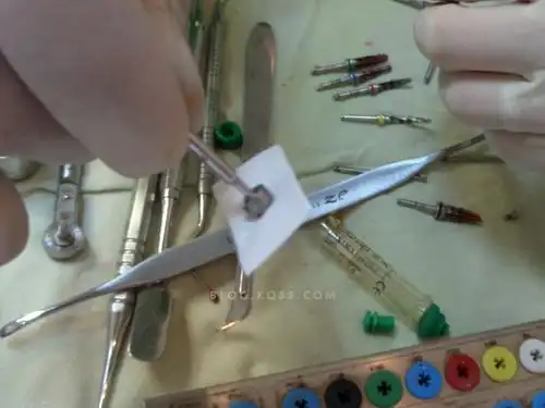 没有钛钉,将就愈合基台固定胶原膜.