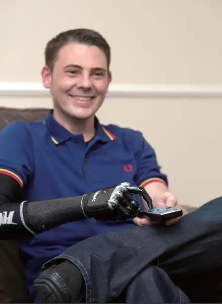 优邦假肢手部假肢日常康复训练