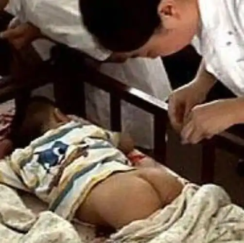 什么是蛲虫病?为什么儿童易患蛲虫病?