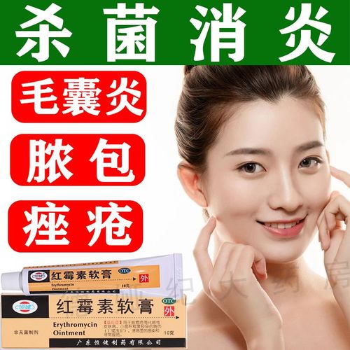 红霉素软膏杀菌消炎抗菌止痒老牌子祛痘青春痘皮肤病化脓性毛囊炎
