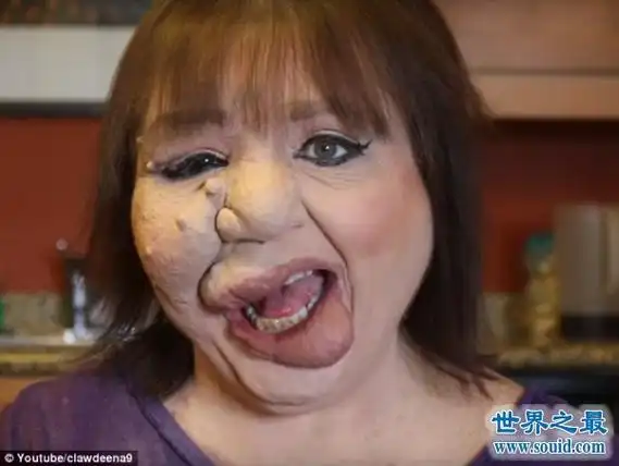 世界上最恶心的人,又丑又恶心的男人女人(慎入)