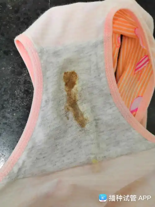 28移植的 今天早上测到很淡的一条  但是刚刚内裤上有褐色的分泌物