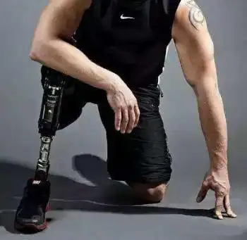 什么是赛姆假肢有什么特点