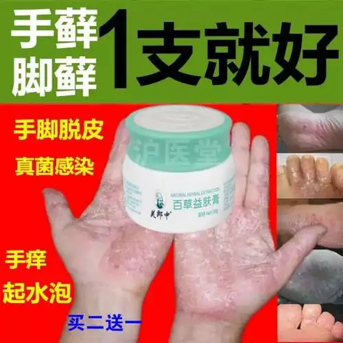 鹅掌风手癣膏手足癣真菌感染水泡手痒脱皮干裂止痒手气膏鹅掌风膏参数