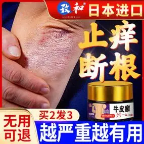 牛皮癣股藓银屑病过敏湿疹止痒根特效去皮肤专用正品杀菌药膏47人付款