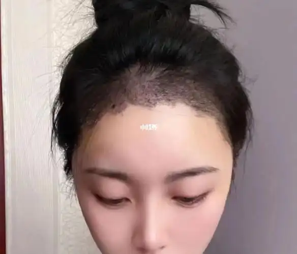 这个发际线形状怎麼样