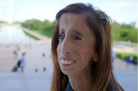 世界上最丑的女人 能坚持看完的算你赢(没有最丑只有更丑)