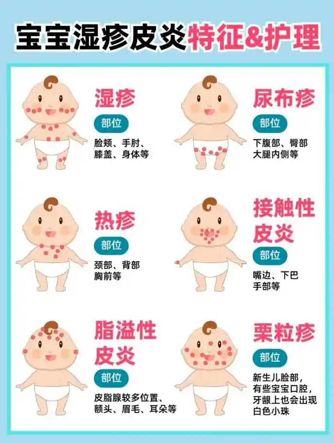 新手爸妈需知;快速区分宝宝,湿疹,热疹,新手爸妈需知;快速区 - 抖音