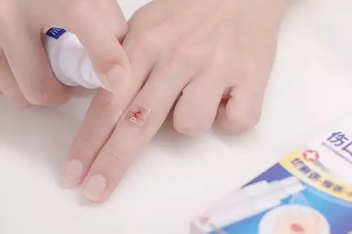 创可贴使用不当造成截肢?