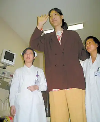 中国第一女巨人姚德芬身高236米曾梦想吃饱饭死因让人心酸