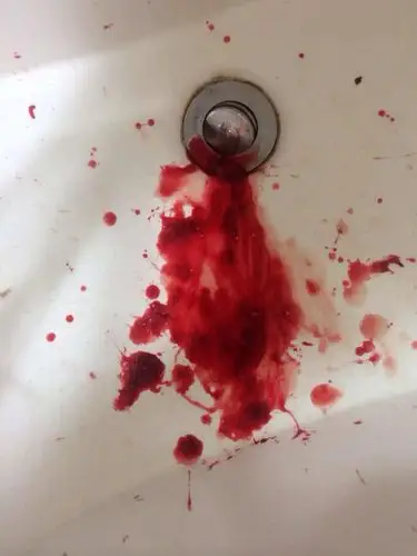 今天下班回家,女朋友突然出血,问她怎么了又不说,急死我了,怎么办?