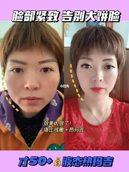 绝呀!介这个少女线有什么作用呢?78提拉紧致78小脸shou脸