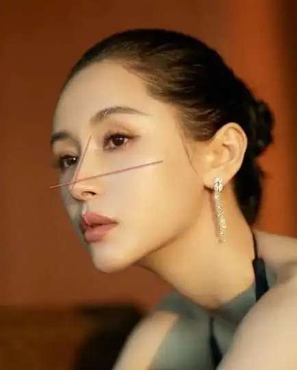 岁月不败美人,王子文面部填充的效果真的让人惊艳!_网易订阅