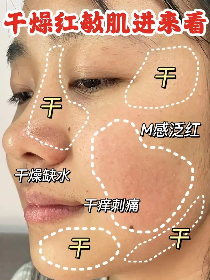 夏天皮肤干燥缺水, - 抖音