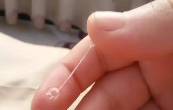 分泌物_问题_阴道