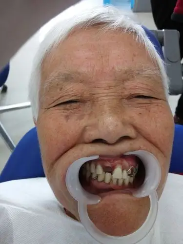 我从这个病例中学到了:认真,认真,再认真! - 美篇