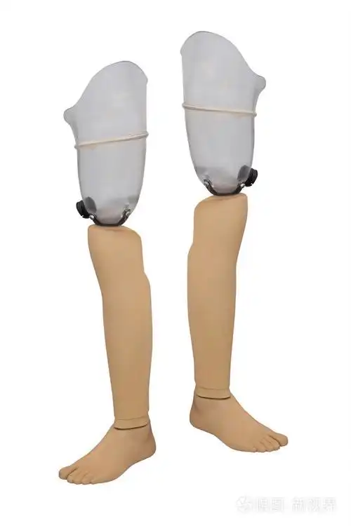 假肢照片-正版商用图片1fn99v-摄图新视界