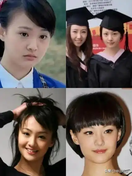 整容郑爽对比郑爽整容的前后对比的图片