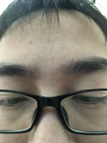 我这个是山根横纹吗?是不是有心脏病风险?_百度知道