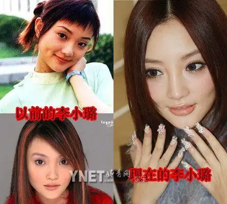李小璐对比照