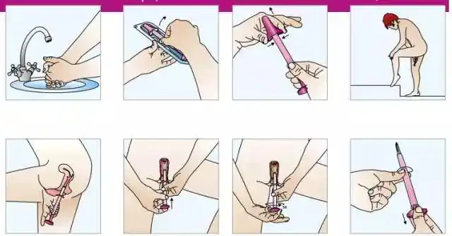 不去医院也能自行采取宫颈癌筛查样本?怎么做?