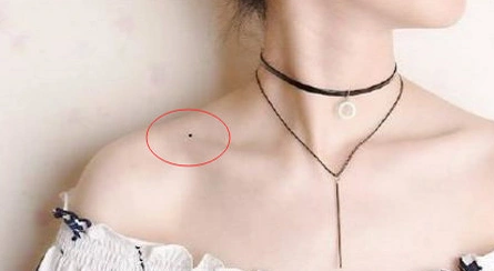 右肩膀锁骨有痣的女人怎么样:色泽纯正,光泽圆润的痣主富贵.