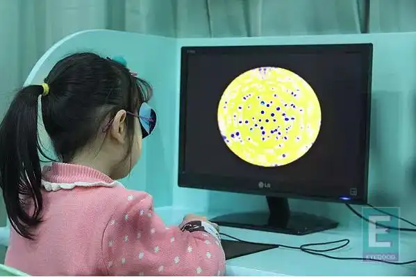 弱视治疗的关键几问