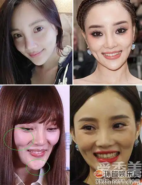 女明星整容前后照片对比 天生丽质反整残!