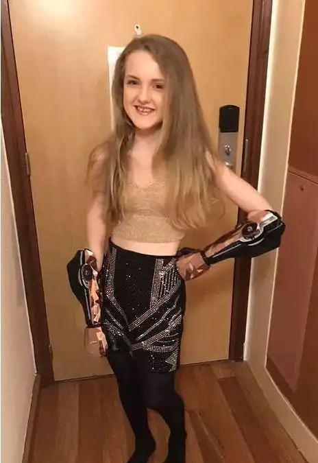 13岁小女孩成#现实版阿丽塔 卡梅隆为她打造机械手臂