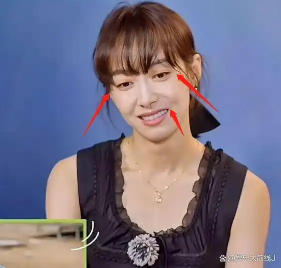 "宋茜36岁近照曝光!法令纹重颧骨有坑引热议,状态差引人关注!