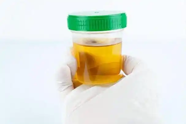 上完厕所最好看一眼,尿液出现这几种颜色要当心了!