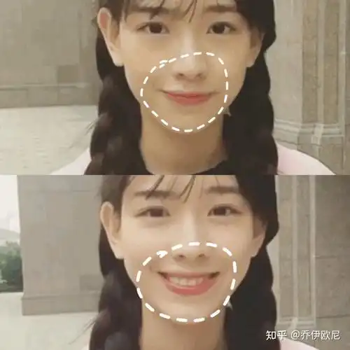 孙一宁做过哪些整形项目?do脸分析 - 知乎