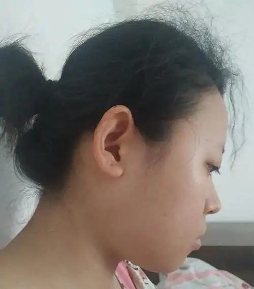 侧脸超级丑是什么体验