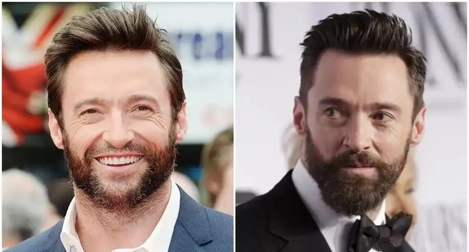 比削骨还见效,男星都是怎么用胡子"整容"的呢