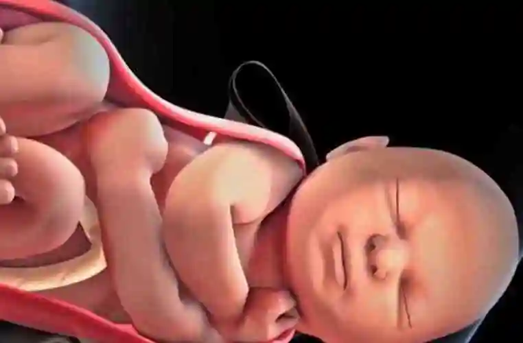 大家知道什么是适于胎龄儿吗有什么评判标准吗