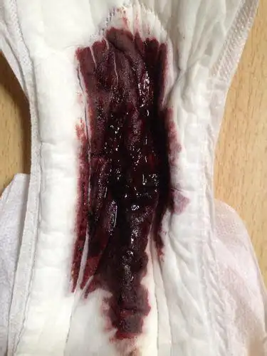 用月经在照片上诅咒他把他照片纹在身上2022已更新今日热点