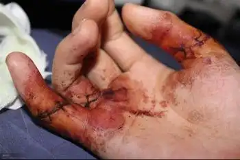 [转载]刀伤药极效方,一次即愈 - zhshch - ♂╮(╯▽╰)╭