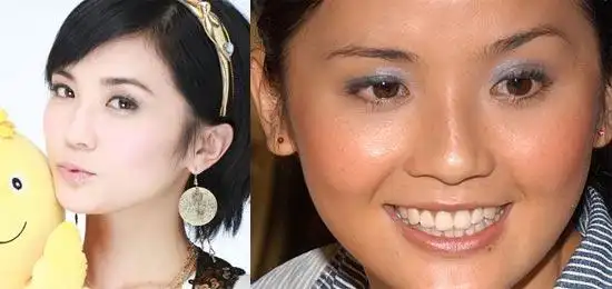 10女星高倍清晰照 好坏皮肤大揭底(组图)