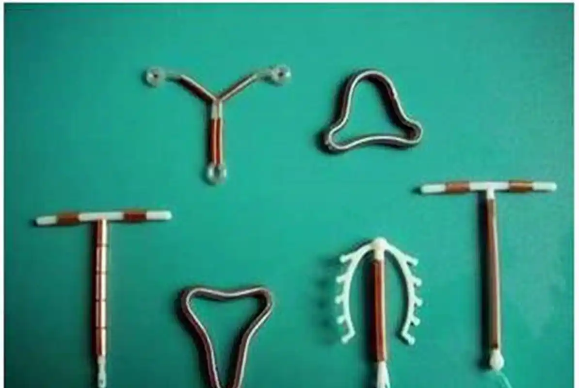 原创节育环体内住十年是啥模样?医生都不忍心直视,太遭罪了