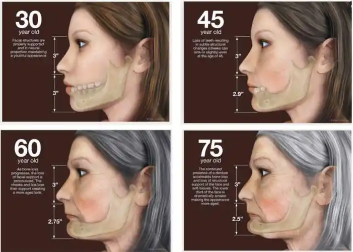 40岁 抗衰老,99.9%的医生不会告诉你_流失_杆菌_患者