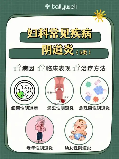 02妇科疾病一炎难尽60探究5种阴道炎症