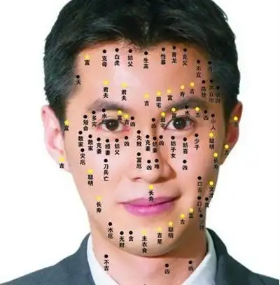 面痣图解男性